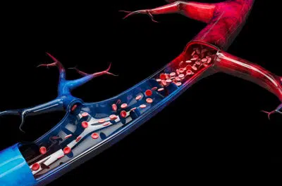 Image graphique d une veine - insuffisance feineuse symptomes et traitements | IK Paris