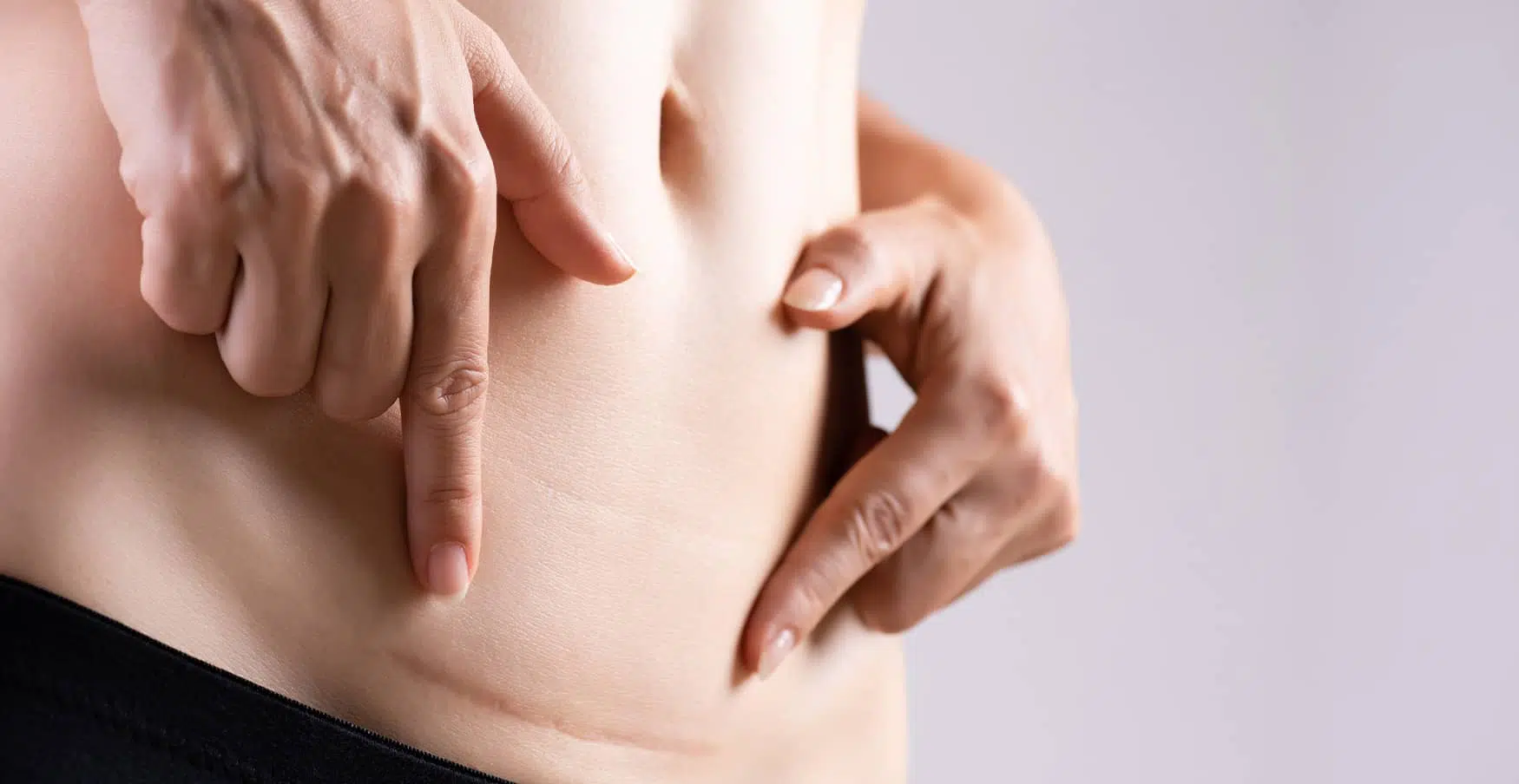 Cicatrices, les causes et traitements, Institut de kinésithérapie | Paris