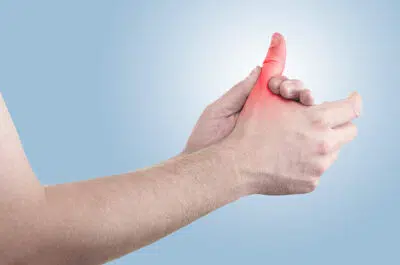 Homme tenant son pouce avec l autre main reeducation fracture pouce | IK Paris