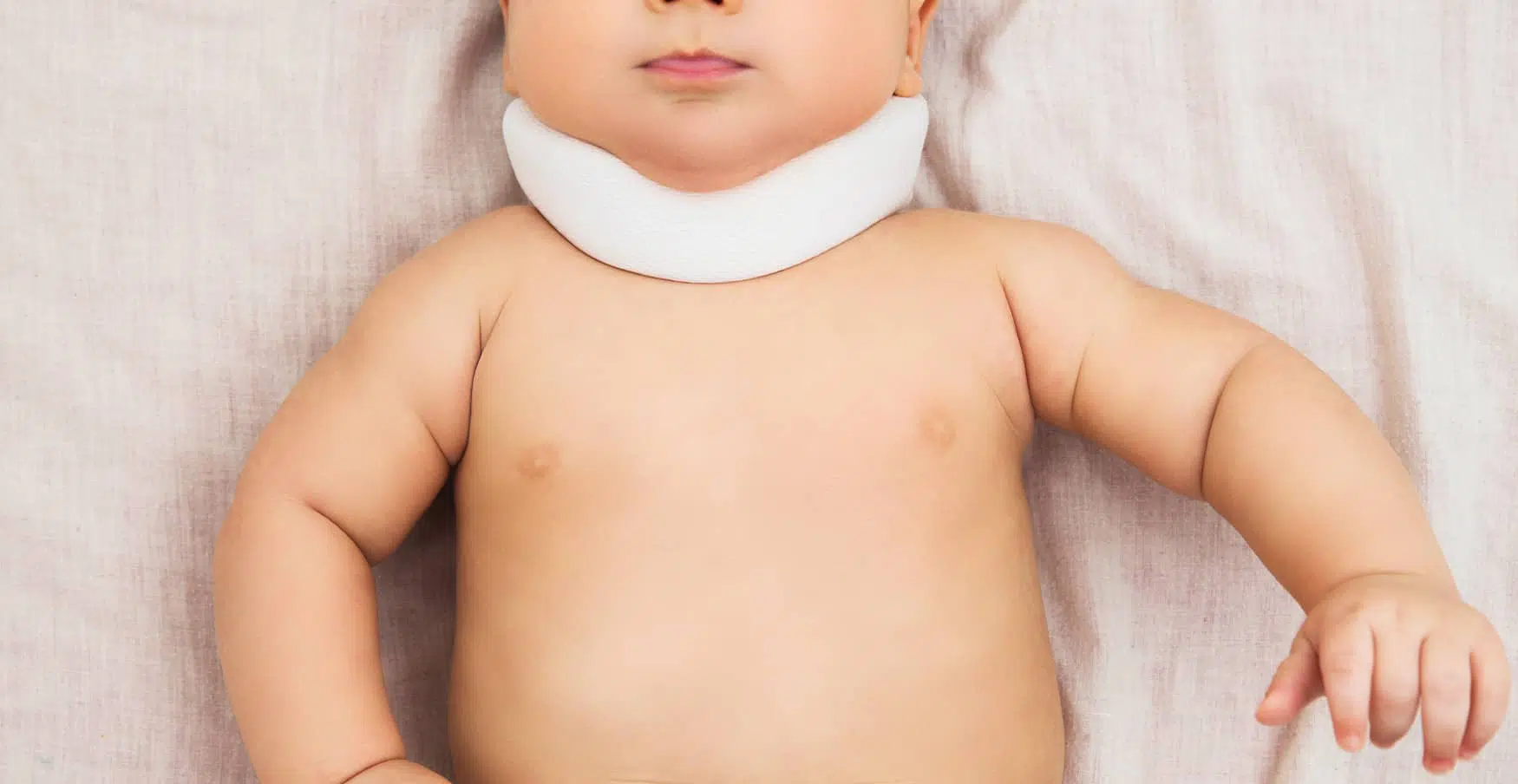 Torticolis congénital, les causes et traitements associés, Institut de kinésithérapie | Paris